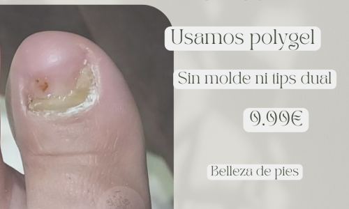 miniatura del curso