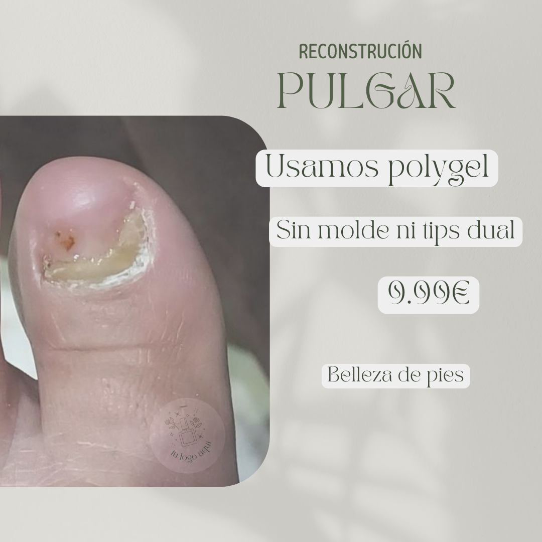 Reconstrucción dedo pulgar del pie con polygel y acrílico, curso online